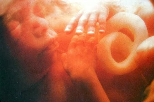 Foetus 5 months